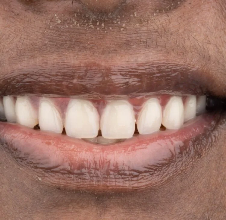 Simpladent Clinics Visakhapatnam - Home 01 Simpladent Clinics Visakhapatnam - Home 01 Simpladent Clinics Smile Profile 2024 10