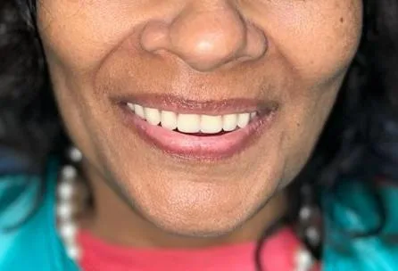 Simpladent Clinics Visakhapatnam - Home 01 Simpladent Clinics Visakhapatnam - Home 01 Simpladent Clinics Smile Profile 2024 3