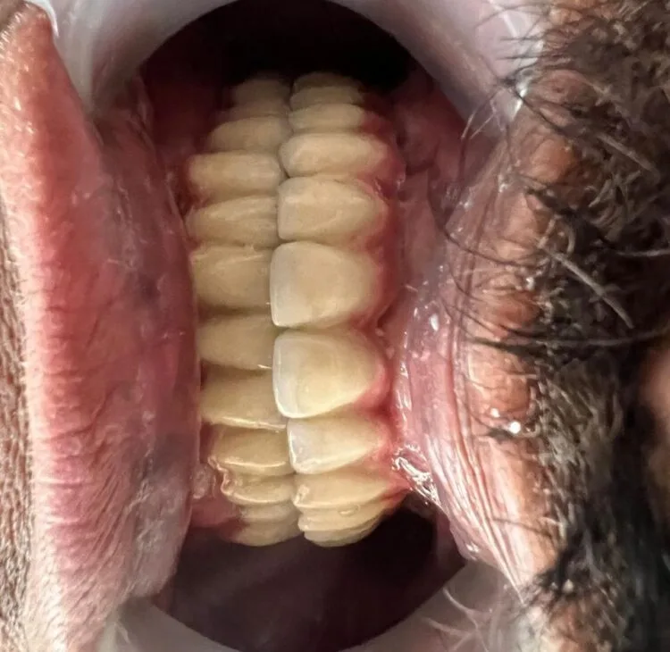 Simpladent Clinics Visakhapatnam - Home 01 Simpladent Clinics Visakhapatnam - Home 01 Smile Profile Simpladent Clinics Visakhapatnam 1