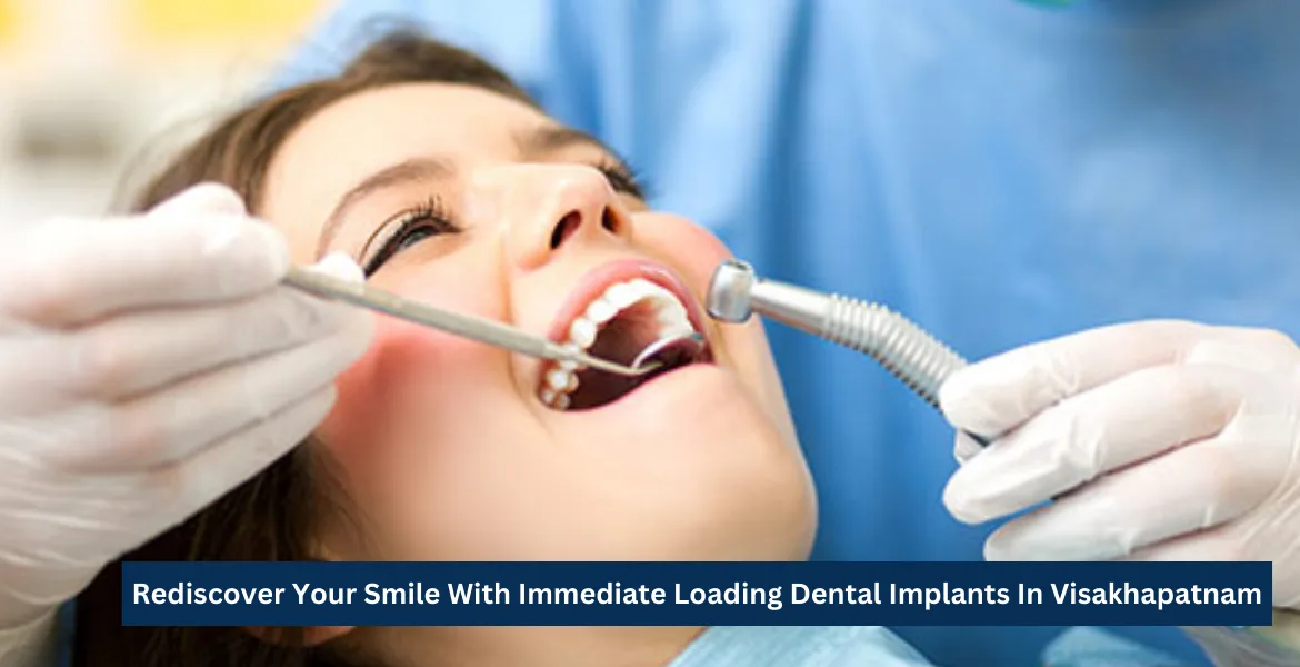 Revolutionary Immediate Loading Dental Implants for Perfect Smile Restoration - Expert Solutions for Missing Teeth