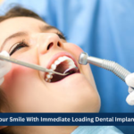 Revolutionary Immediate Loading Dental Implants for Perfect Smile Restoration - Expert Solutions for Missing Teeth