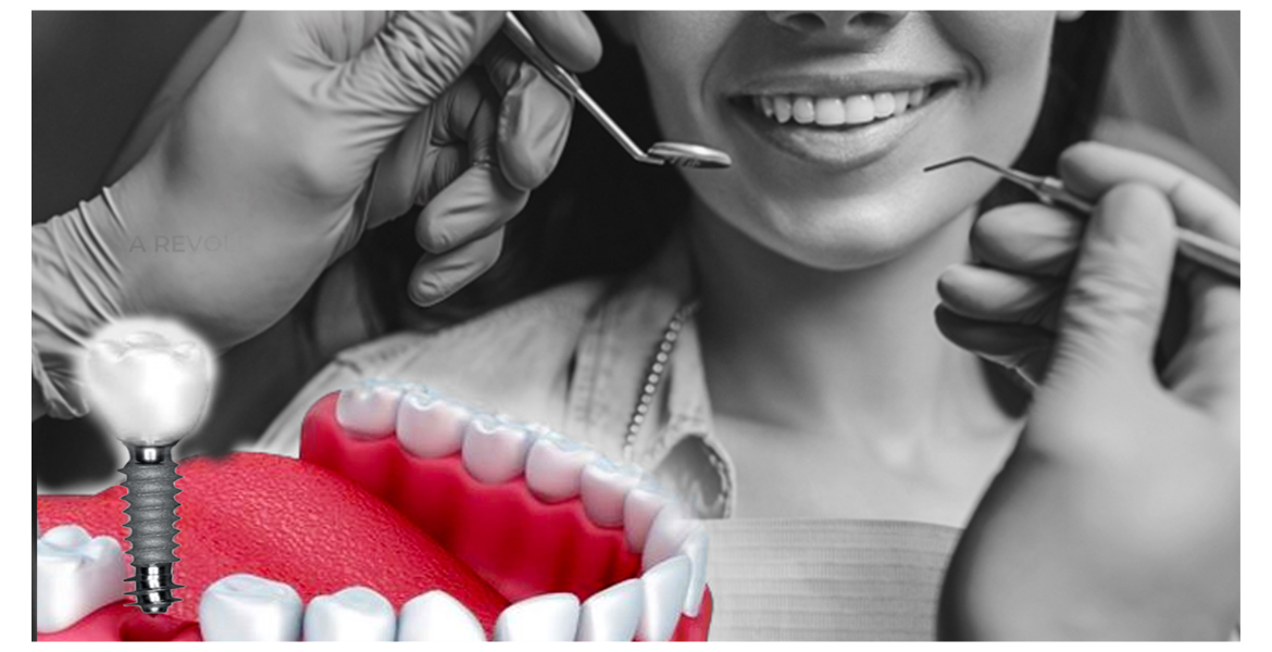 Simpladent Clinics Visakhapatnam - Best Implantologist Doctors In Visakhapatnam -Dr. Manohar Varma Best implantologist doctors in Visakhapatnam expert dental implants painless treatment advanced tooth restoration