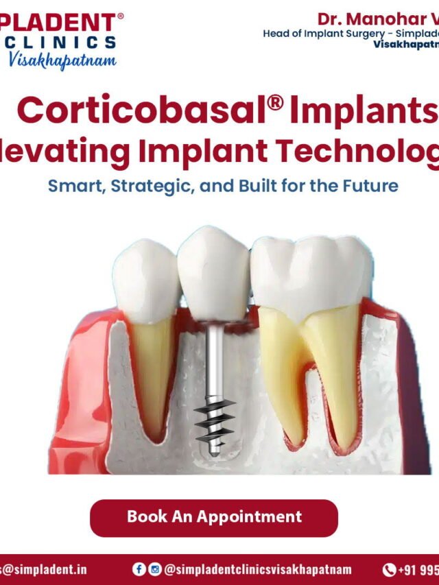 Elevate Your Smile with Corticobasal® Implants – The Future of Tooth Replacement