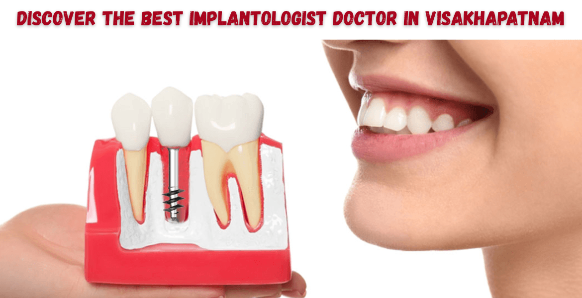 Simpladent Clinics Visakhapatnam - Discover The Best Implantologist Doctor In Visakhapatnam: Dr. Manohar Varma Top implantologist in Visakhapatnam Dr. Manohar Varma expert dental implants smile makeover permanent teeth