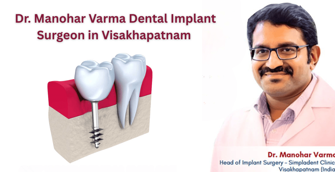 Simpladent Clinics Visakhapatnam - Dr. Manohar Varma Dental Implant Surgeon in Visakhapatnam – Leading Expert in Implantology Experienced dental implant surgeon, best implantologist near me, advanced dental implant surgery, full mouth dental implants expert, painless dental implant procedure, permanent teeth replacement