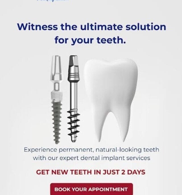 Simpladent Clinics Visakhapatnam - Stories Best dental clinic Vizag, smile makeover, advanced dental implants, cosmetic dentistry Vizag, teeth whitening, ultimate smile solution